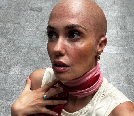 Агата Муцениеце испугала поклонников лысой головой