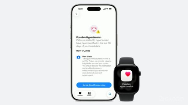Apple представила смарт-часы Watch Series 11 &mdash; самые тонкие, с 5G и детектором гипертонии за $399 (5 фото)