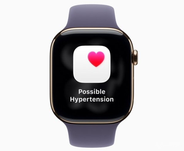 Apple выпустила watchOS 26: дизайн Liquid Glass, новые функции Apple Intelligence и мониторинг гипертонии (8 фото)