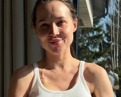 Нынешний избранник Лерчек обвинил следствие в нарушении ее прав на лечение