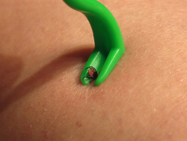 Почему так важно защититься от клещей весной: пять способов