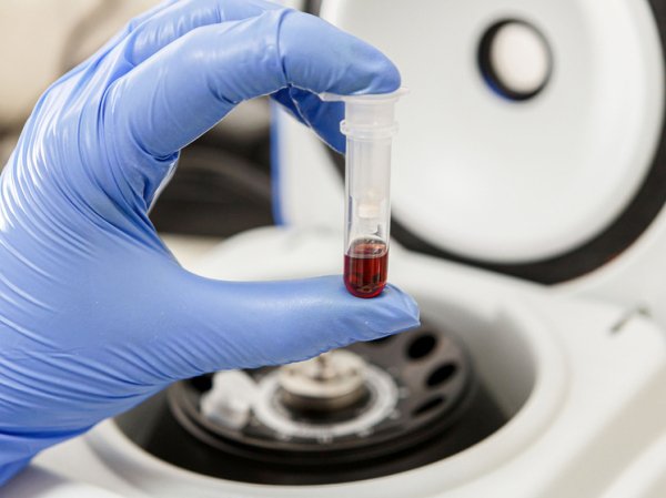 Исследование выявило разницу риска рака между женатыми и одинокими